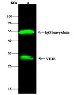 VTI1B Antibody in Immunoprecipitation (IP)
