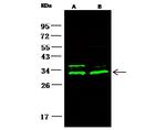 14-3-3 beta Polyclonal Antibody