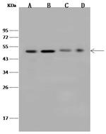ZNF830 Antibody in Western Blot (WB)