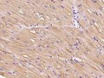 HSPB8 Antibody in Immunohistochemistry (Paraffin) (IHC (P))