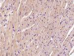 HSPB8 Antibody in Immunohistochemistry (Paraffin) (IHC (P))