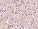 HSPB8 Antibody in Immunohistochemistry (Paraffin) (IHC (P))