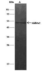 ALDH3A2 Antibody in Immunoprecipitation (IP)