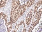 ARL4A Polyclonal Antibody