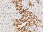 CaMKII alpha Polyclonal Antibody