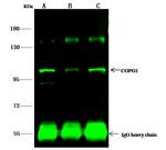 COPG Antibody in Immunoprecipitation (IP)
