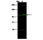 COPG Polyclonal Antibody