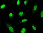 CSDC2 Antibody in Immunocytochemistry (ICC/IF)