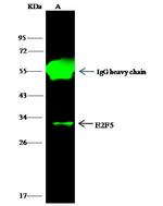 E2F5 Antibody in Immunoprecipitation (IP)