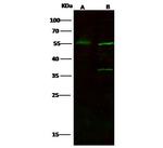 FOXA1 Polyclonal Antibody