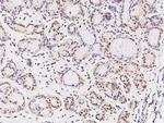 FOXK1 Antibody in Immunohistochemistry (Paraffin) (IHC (P))