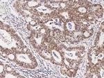 FOXK1 Antibody in Immunohistochemistry (Paraffin) (IHC (P))