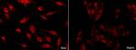 GLI1 Polyclonal Antibody