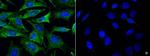 GluR6 Polyclonal Antibody