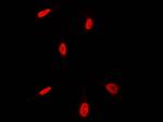 HEXIM1 Polyclonal Antibody