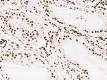 KLF7 Antibody in Immunohistochemistry (Paraffin) (IHC (P))