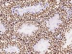 KLF7 Antibody in Immunohistochemistry (Paraffin) (IHC (P))