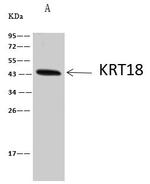 Cytokeratin 18 Antibody in Immunoprecipitation (IP)