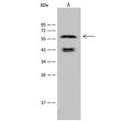 Cytokeratin 6A Polyclonal Antibody