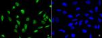 PDCD4 Polyclonal Antibody