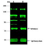 RSK1 Antibody in Immunoprecipitation (IP)