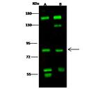 RSK1 Polyclonal Antibody