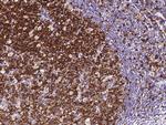 Stathmin 1 Antibody in Immunohistochemistry (Paraffin) (IHC (P))