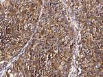 Stathmin 1 Antibody in Immunohistochemistry (Paraffin) (IHC (P))