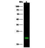 Stathmin 1 Antibody in Western Blot (WB)