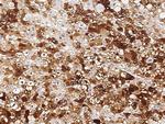 OX40L Antibody in Immunohistochemistry (Paraffin) (IHC (P))