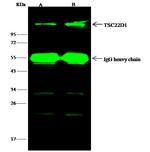 TSC22D1 Antibody in Immunoprecipitation (IP)