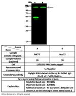 TSC22D1 Polyclonal Antibody