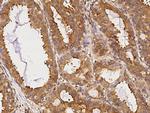 alpha Tubulin Antibody in Immunohistochemistry (Paraffin) (IHC (P))