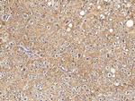 alpha Tubulin Antibody in Immunohistochemistry (Paraffin) (IHC (P))
