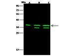 Thymidylate Synthase Polyclonal Antibody