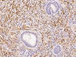 Actin Antibody in Immunohistochemistry (Paraffin) (IHC (P))