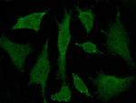 BRE Polyclonal Antibody