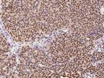 CAND1 Antibody in Immunohistochemistry (Paraffin) (IHC (P))