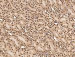 CAND1 Antibody in Immunohistochemistry (Paraffin) (IHC (P))