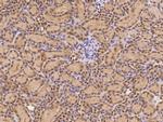 CAND1 Antibody in Immunohistochemistry (Paraffin) (IHC (P))