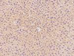 CPT2 Antibody in Immunohistochemistry (Paraffin) (IHC (P))