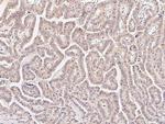 METAP2 Polyclonal Antibody