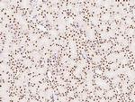 PTBP1 Antibody in Immunohistochemistry (Paraffin) (IHC (P))