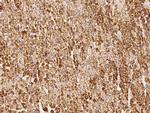 VDAC Antibody in Immunohistochemistry (Paraffin) (IHC (P))