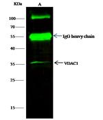 VDAC Antibody in Immunoprecipitation (IP)