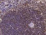 CD45 Antibody in Immunohistochemistry (Paraffin) (IHC (P))