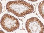 GFR alpha-3 Antibody in Immunohistochemistry (Paraffin) (IHC (P))