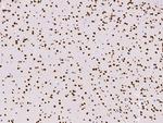 HNF6 Antibody in Immunohistochemistry (Paraffin) (IHC (P))
