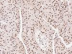 HNF6 Antibody in Immunohistochemistry (Paraffin) (IHC (P))