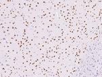 HNF6 Antibody in Immunohistochemistry (Paraffin) (IHC (P))